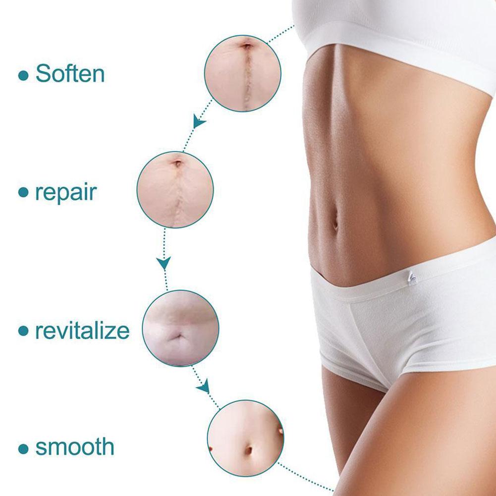 Zakdavi™ SmoothSkin Silicone Scar Sheets