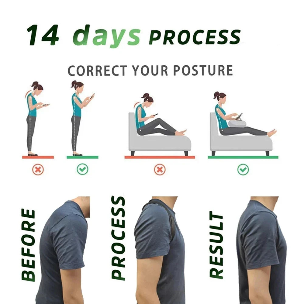 Seurico™ Premium Posture Corrector Belt – Straighten Your Spine & Relieve Pain Instantly